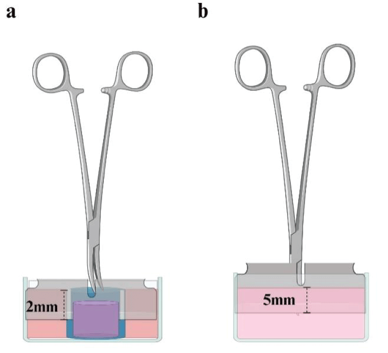Devices to create wounds on FPCLs. Standardization of wounds was achieved through a sterilized stainless-steel knife coupled with Kelly forceps. For relaxed FPCL it was necessary to hold the lattice by introducing it into a plastic straw with a slit that would allow the knife to fit exactly 2 mm (a). For stressed FPCLs, the fit distance of the knife was 5 mm measured from the tip of Kelly forceps to the knife edge, in order to reach the exact depth into the de lattice when the tip of the forceps had touched the surface of the FPCLs (b). Created with BioRender.com.