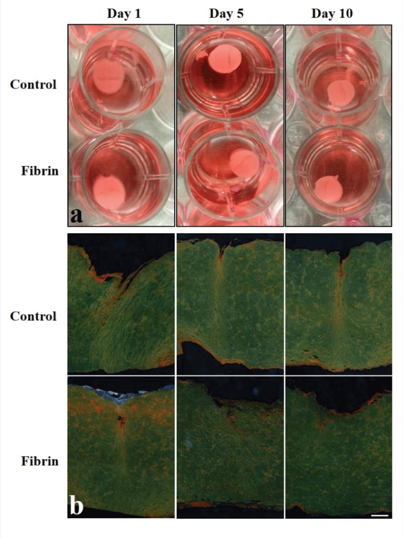 Relaxed FPCLs. a) Pictures of representative relaxed FPCL of control and fibrin treated at different time points, 1, 5, and 10 days. b) Photomicrographs of cross sections of relaxed FPCLs stained with picrosirius red. The bar represents 200 μm.