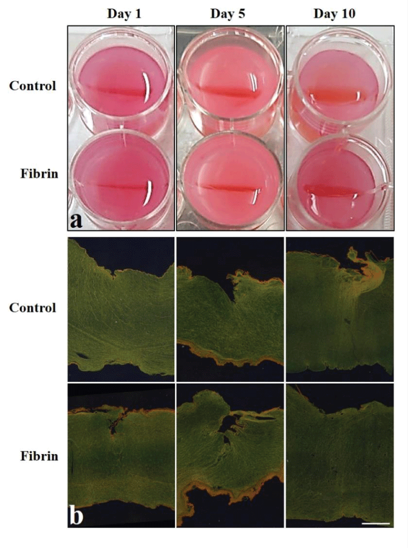 Stressed FPCLs. a) Pictures of representative stressed FPCL of control and fibrin treated at different time points, 1, 5, and 10 days. b) Photomicrographs of cross sections of stressed FPCLs stained with picrosirius red. The bar represents 500 μm.
